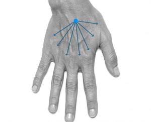 El dolgusu uygulaması İzmir Alsancak muayenehanesinde Dr. Orhan Demirer ile ellerde hacim kaybının giderilmesi ve genç görünüm